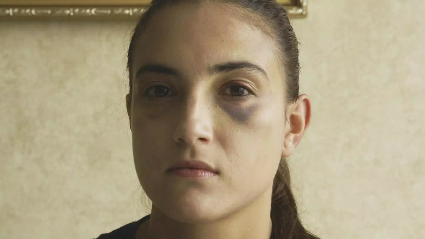 "Por qué aguanté 4 golpizas de mi novio antes de denunciarlo"