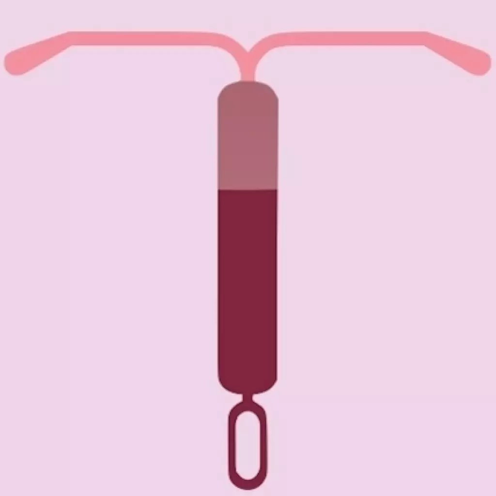 Anticonceptivos, 5 razones para usarlos.