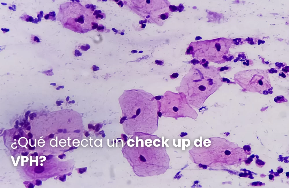 ¿Qué detecta un check up de VPH?